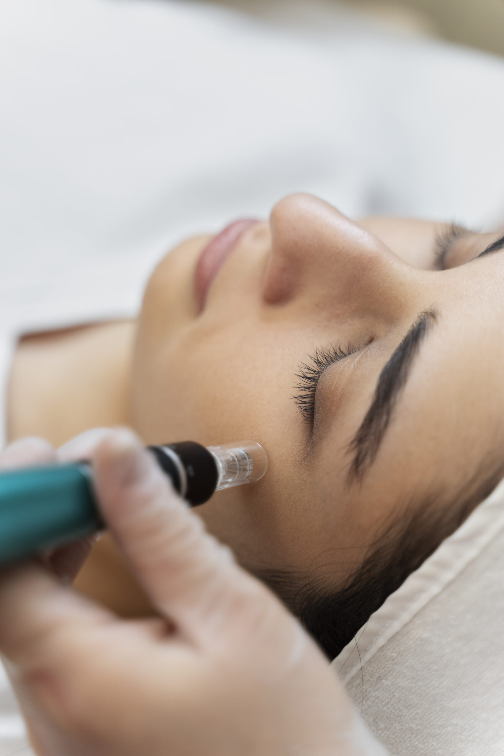 person-getting-micro-needling-beauty-treatment